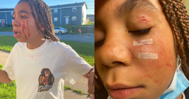 12-year-old Taizanah’zian Fletcher was bitten by her neighbour’s dog on September 11, 2021.