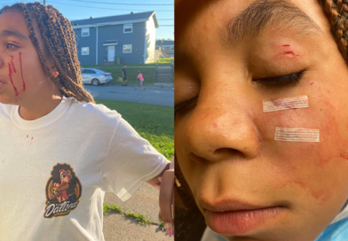 12-year-old Taizanah’zian Fletcher was bitten by her neighbour’s dog on September 11, 2021.