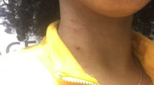 ‘This town is very racist’: African student in Wolfville speaks out about experience with RCMP, mayor after filing complaint about an assault